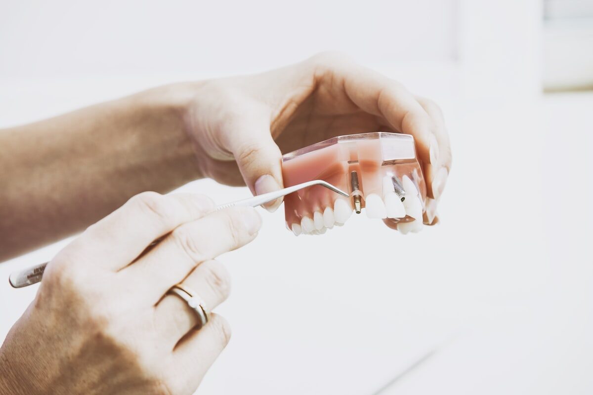 Modelo de prótese dentária